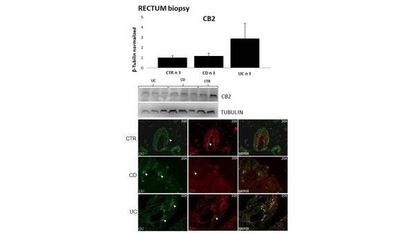 Expression of CB2 receptor in rectum biopsies